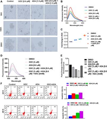 <mark class="highlighted">Adapalene</mark> inhibits the growth of triple-negative breast cancer cells by S-phase arrest and potentiates the antitumor efficacy of GDC-0941